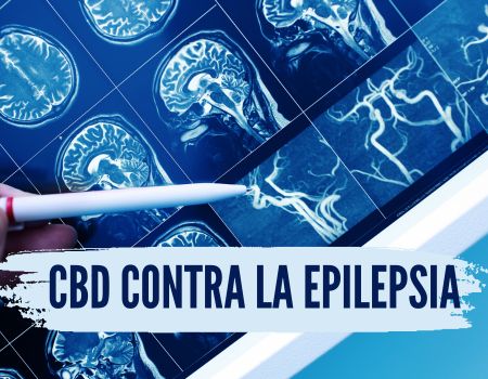 cbd ayuda contra la epilepsia